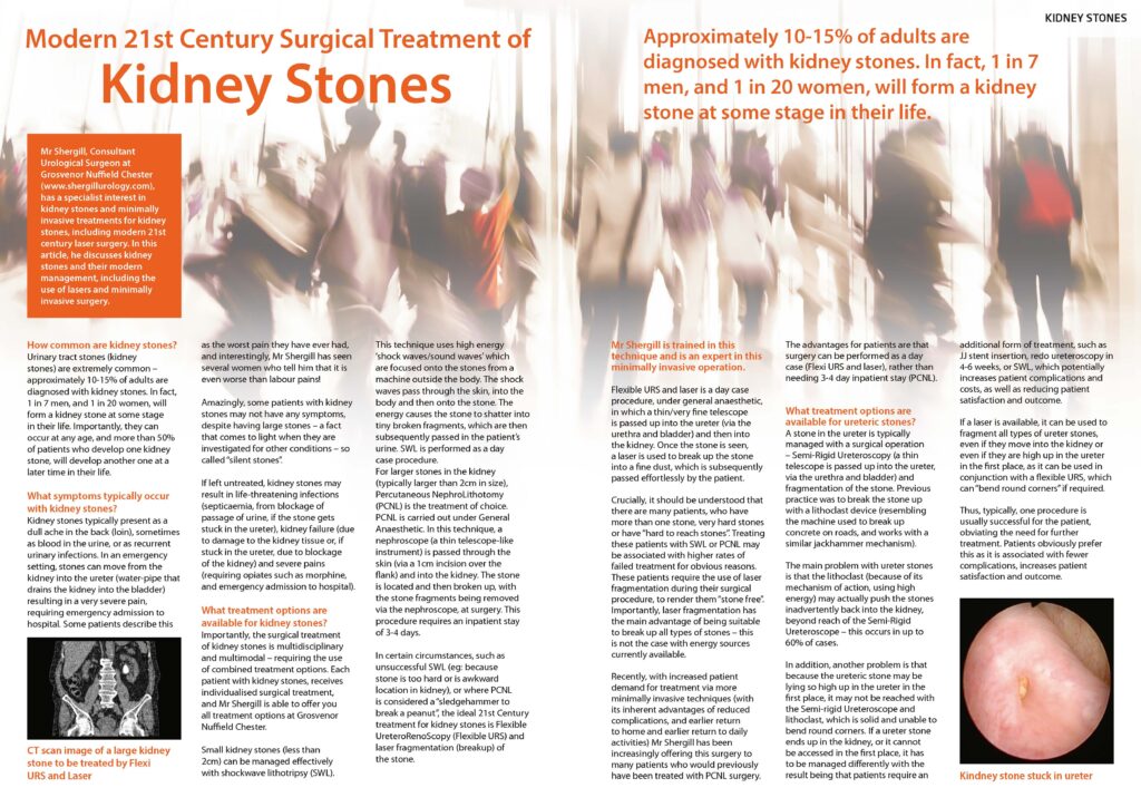 Kidney_Stones